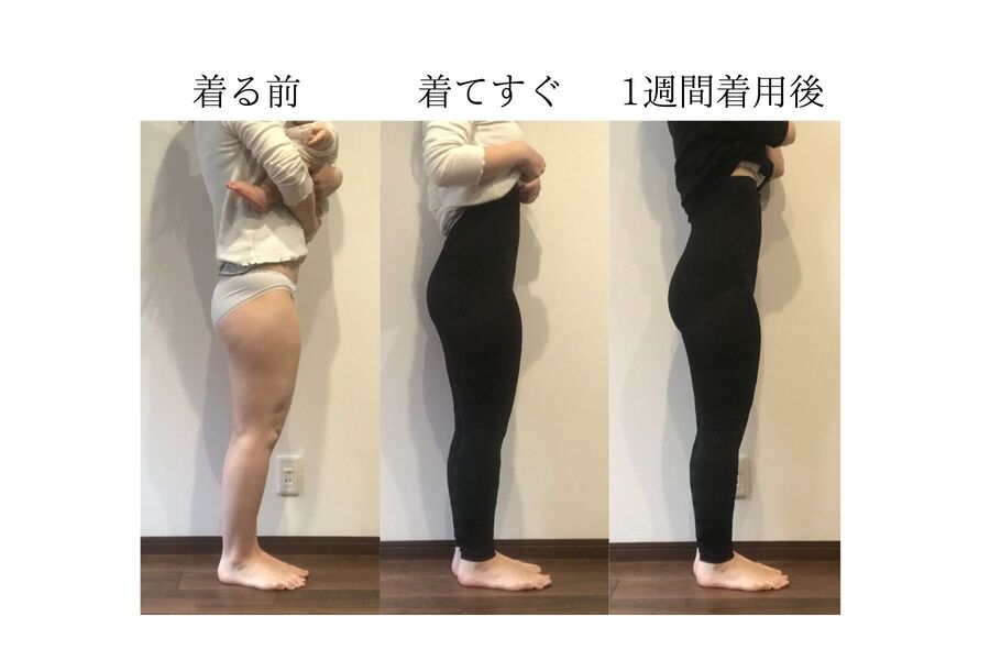 グラマラスパッツは効果ある?むくみ歴15年の私が実際にお試し