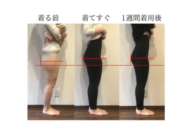 グラマラスパッツはむくみに効果がある?着用前後の写真で見た目の効果を検証